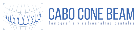 Cabo Cone Beam